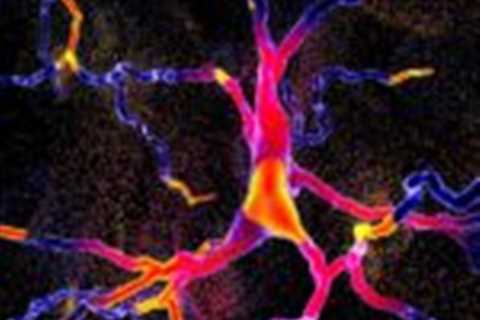 Dopamine agonists, DRIs similar for quality of life in Parkinson’s disease