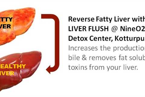 Fatty Liver Detox - Best Way to Detox Your Liver Naturally