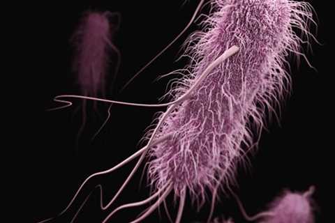 Study Finds Antimicrobial Resistance Is Making UTIs More Deadly