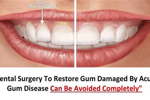 Restore gums naturally