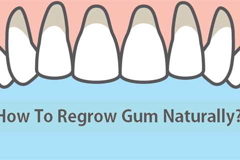 How To Regrow Receding Gums At Home Naturally?