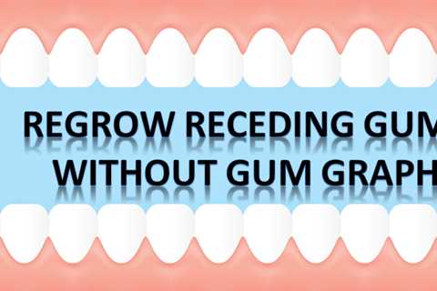 Can Receding Gums Grow Back Naturally - SuperFoodish.com