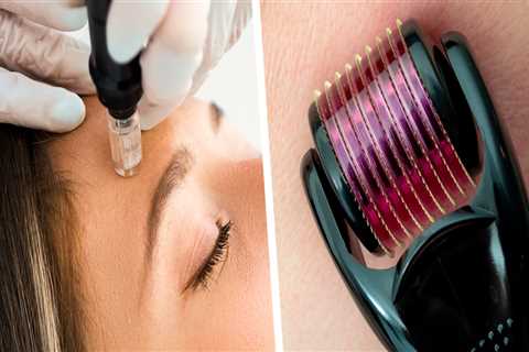 How long do cosmetic devices last?