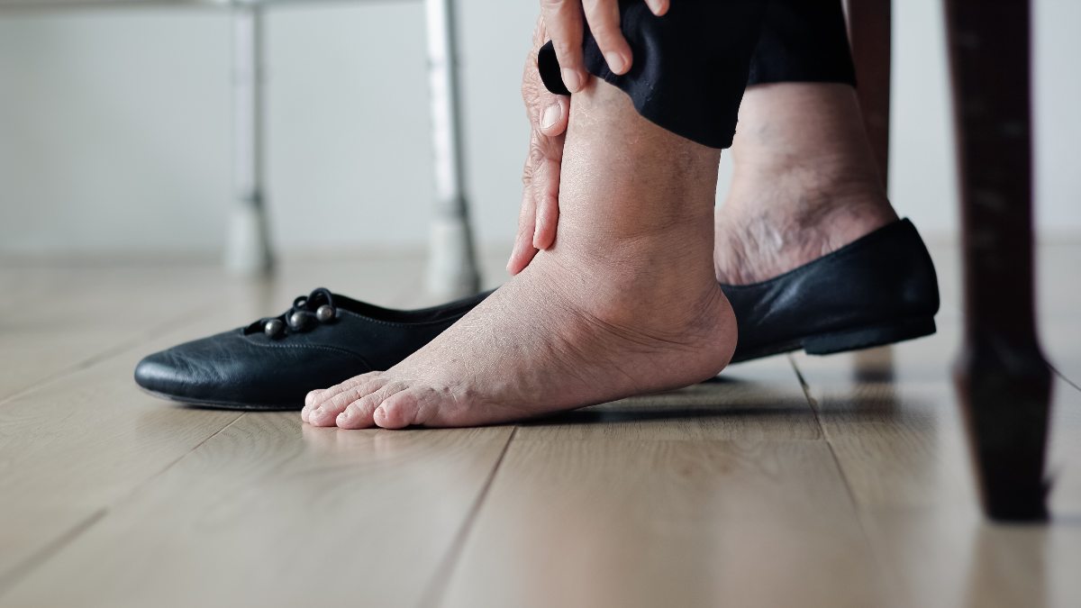 Experts Weigh In: 'Why Are My Ankles So Swollen?'