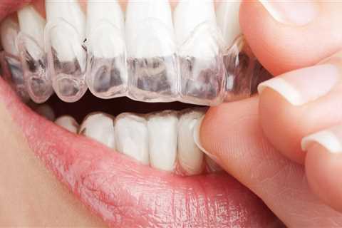 Who does invisalign?