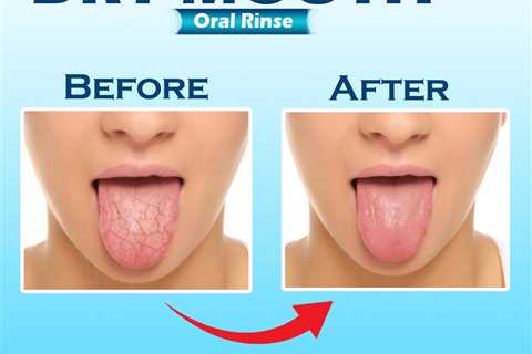 Dry Mouth at Night Treatment
