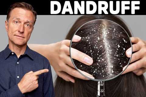 The REAL Cause and Cure for DANDRUFF