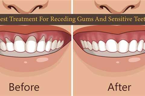 Non-Surgical Receding Gum Treatment