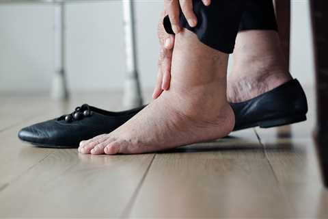 Experts Weigh In: 'Why Are My Ankles So Swollen?'