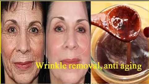 Wrinkle removal, anti aging | mouth wrinkles | get instant face natural lifting | Remove wrinkles