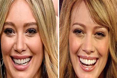 How do celebrities get nice teeth?