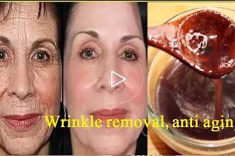 Wrinkle removal, anti aging | mouth wrinkles | get instant face natural lifting | Remove wrinkles