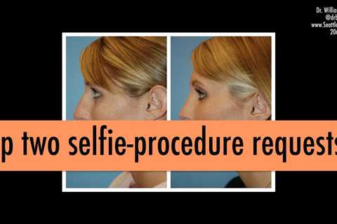 Top Procedure Requests for Best Selfie Photos | The Seattle Facial Plastic Surgery Center