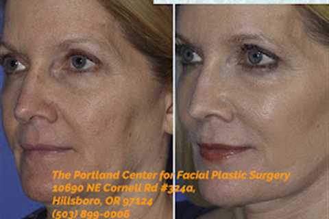 The Portland Center for Facial Plastic Surgery