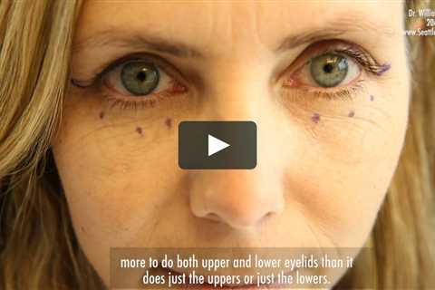 Blepharoplasty Surgery in Portland Oregon