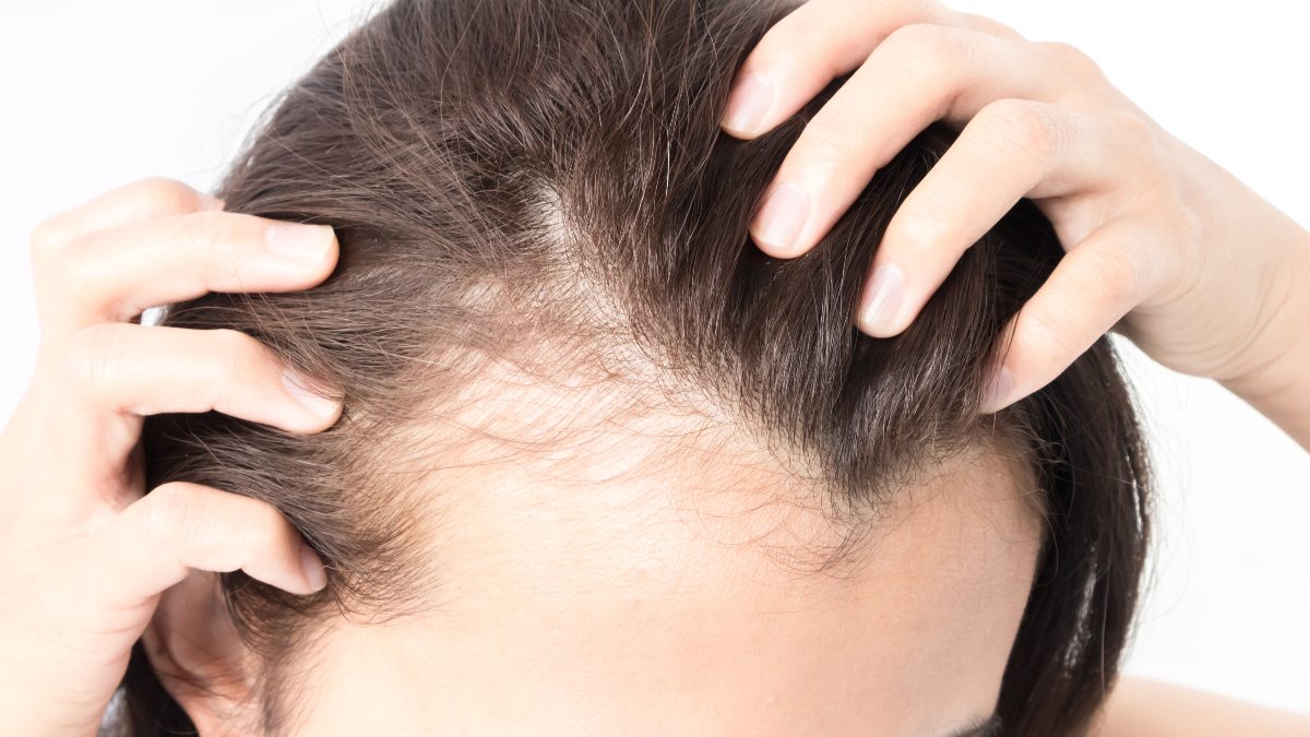 Outsmart Thinning Hair With 3 Natural Thickening Tips