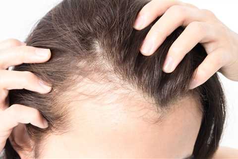 Outsmart Thinning Hair With 3 Natural Thickening Tips