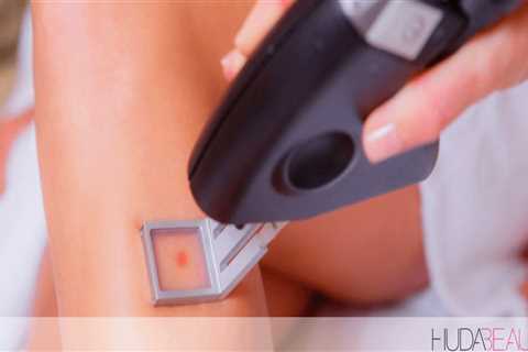 What is the latest technology in laser hair removal?