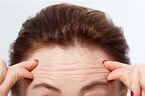 10 Ways to Effectively Reduce Forehead Wrinkles That Don’t Cost a Fortune