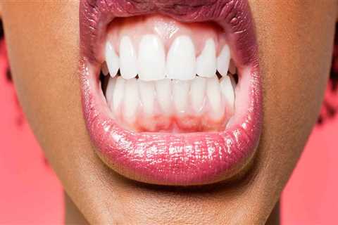 Do gums grow back after laser surgery?