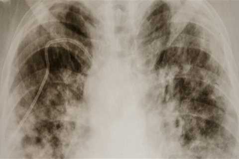 Does delta 8 affect the lungs?