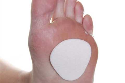 Metatarsal Pads 1/8 inch Felt