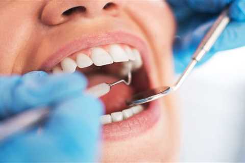 Why is a Regular Dental Check-Up Important? - The Haze