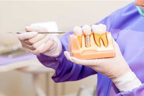 7 Permanent Tooth Replacement Options For Missing Teeth - Rhoades Dentistry