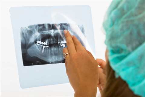 Getting a Dental Implant? Here's How to Prepare - Prim Mart