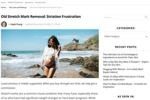 Treating Stretch Marks: Laser Therapy, Microdermabrasion, and More