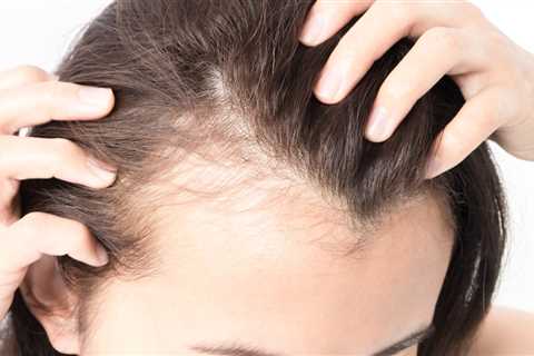 Medical Mystery: Hair Thinning, Chronic Pain, and Inflammation — What Caused This TikToker's..