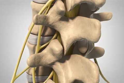 Ask the Doc – Facet Joint Injections