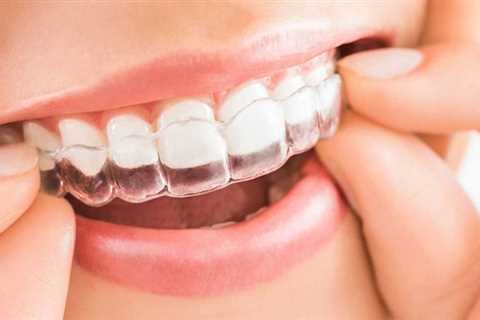 Natural Remedies For Gum Infection - Get your healthy smile back with natural remedies - Natures..