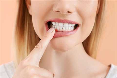 Thin Gums: How to Strengthen Them - CASH CARE DOCTOR