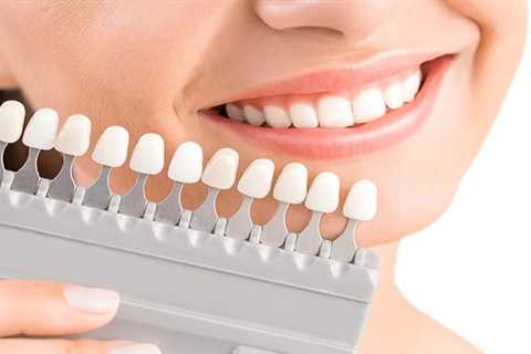 Types of Cosmetic Dentistry- Fort Lauderdale  - Densipaper