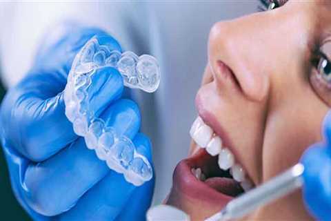 Cosmetic Dentistry: Invisalign San Antonio For Teeth Straightening Without Braces