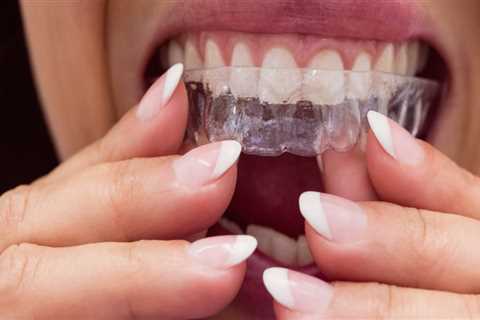 What is the Difference Between Invisalign Providers? A Comprehensive Guide