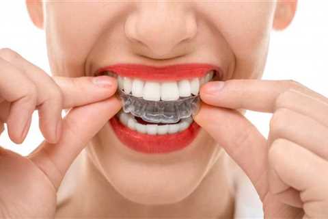 Choosing the Right Invisalign Dentist for Your Child's Treatment