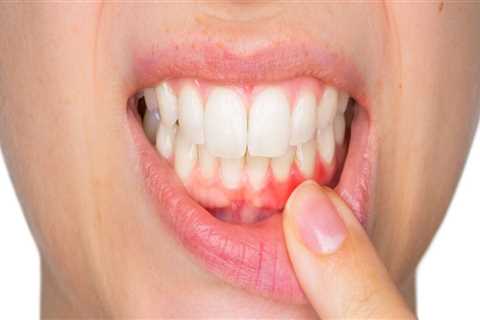 Can advanced periodontitis be cured?