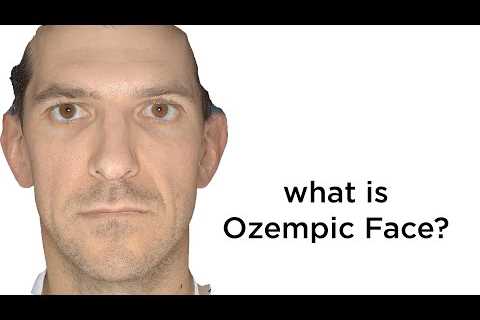 This Is What Ozempic Face Looks Like | Facial Wasting After Rapid Weight Loss | Mounjaro | Wegovy