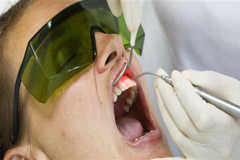 Reasons To Choose Laser Dentistry For Your Dental Care In Mansfield