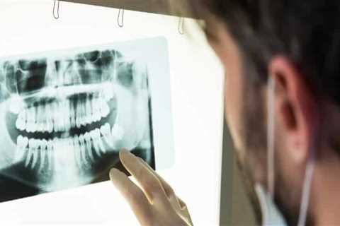 How do i know if i need dental x-rays?