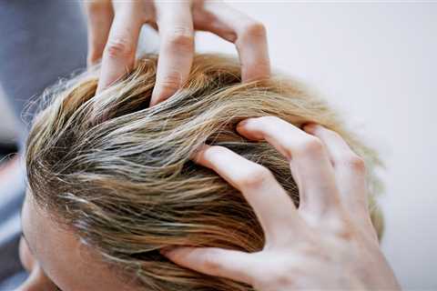 Hair Transplant In Indore Fundamentals Explained