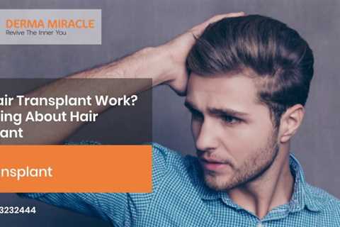 The Basic Principles Of Hair Transplant In Indore