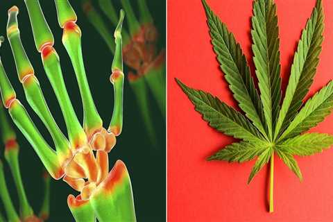 Can Hemp Help with Pain Relief?