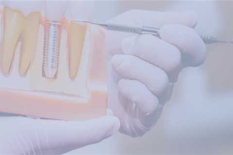 Are dental implants expensive?