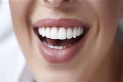 What is the best way to get perfect teeth?