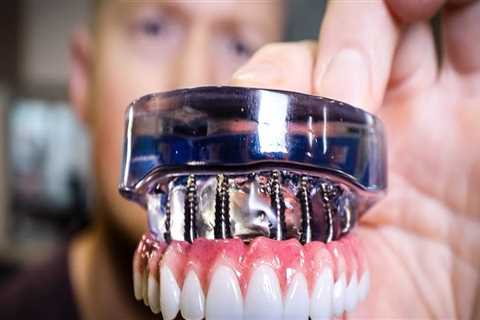 Transform Your Smile With Dental Implants In Dripping Springs