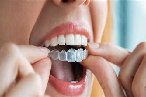 What Services Do Invisalign Dentists Provide?