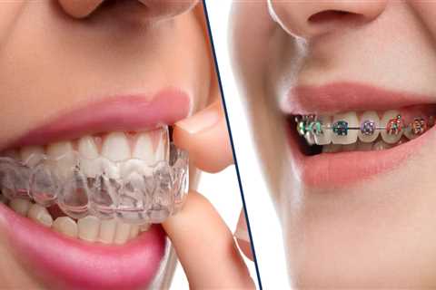 What is the Difference Between an Orthodontist and an Invisalign Dentist?